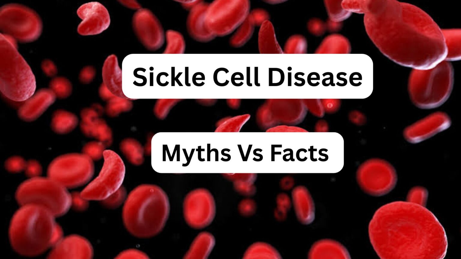 Sickle Cell Disease: 10 Myths vs Facts You Must Know
