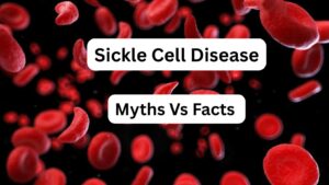 Sickle Cell Disease: 10 Myths vs Facts You Must Know