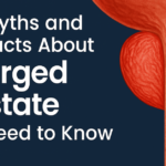 myths and facts about enlarged prostate 2
